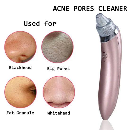 4-in-1 Rechargeable Acne Pore Vacuum Cleaner And Blackhead Remover