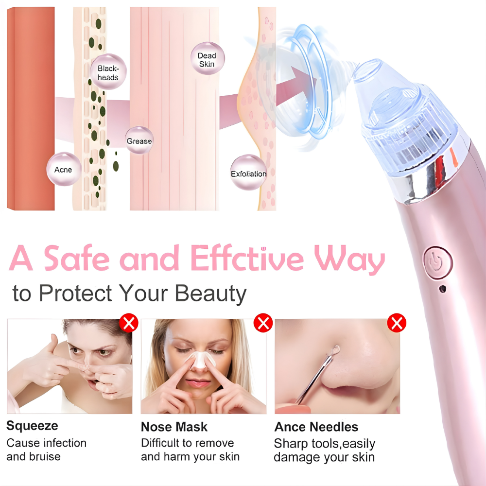 4-in-1 Rechargeable Acne Pore Vacuum Cleaner And Blackhead Remover